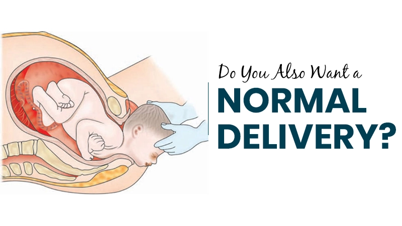 Do You Also Want a Normal Delivery? Service